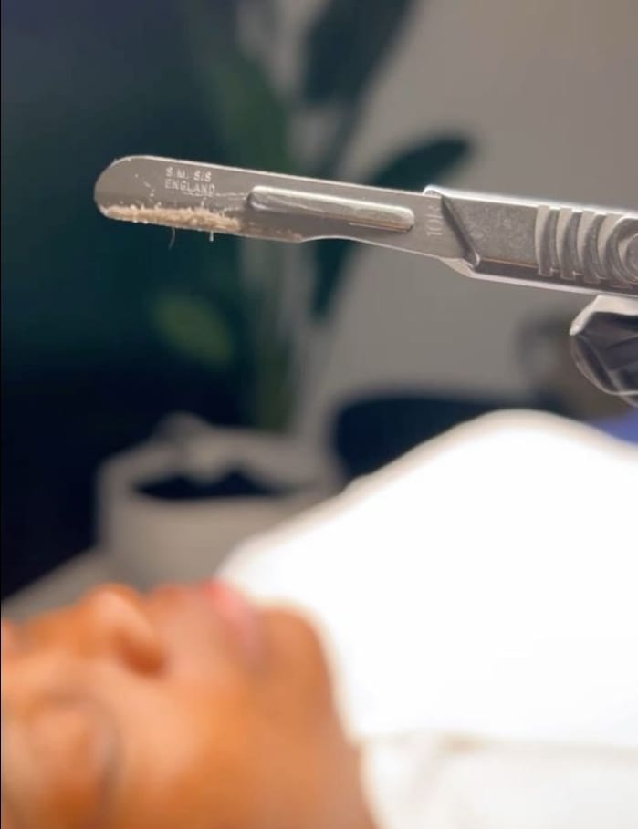 Formation Dermaplaning – Format Numérique